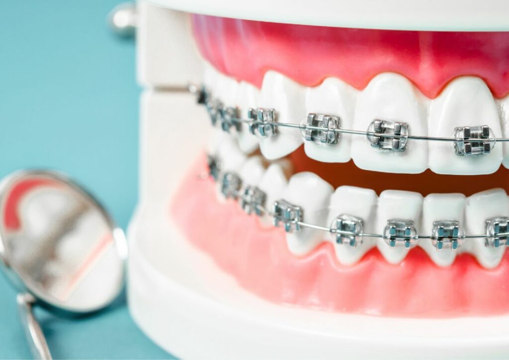 ortodonta w wilanowie, mokotowie, konstancinie, ursynowie, wawrze
