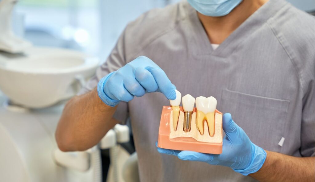 Braki zębowe - więcej niż estetyka. Dlaczego brak jednego zęba to początek problemów i jak nowoczesna implantologia ratuje Twój uśmiech?