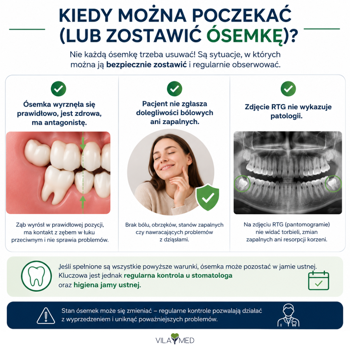 Kiedy usunąć ósemki Vilamed