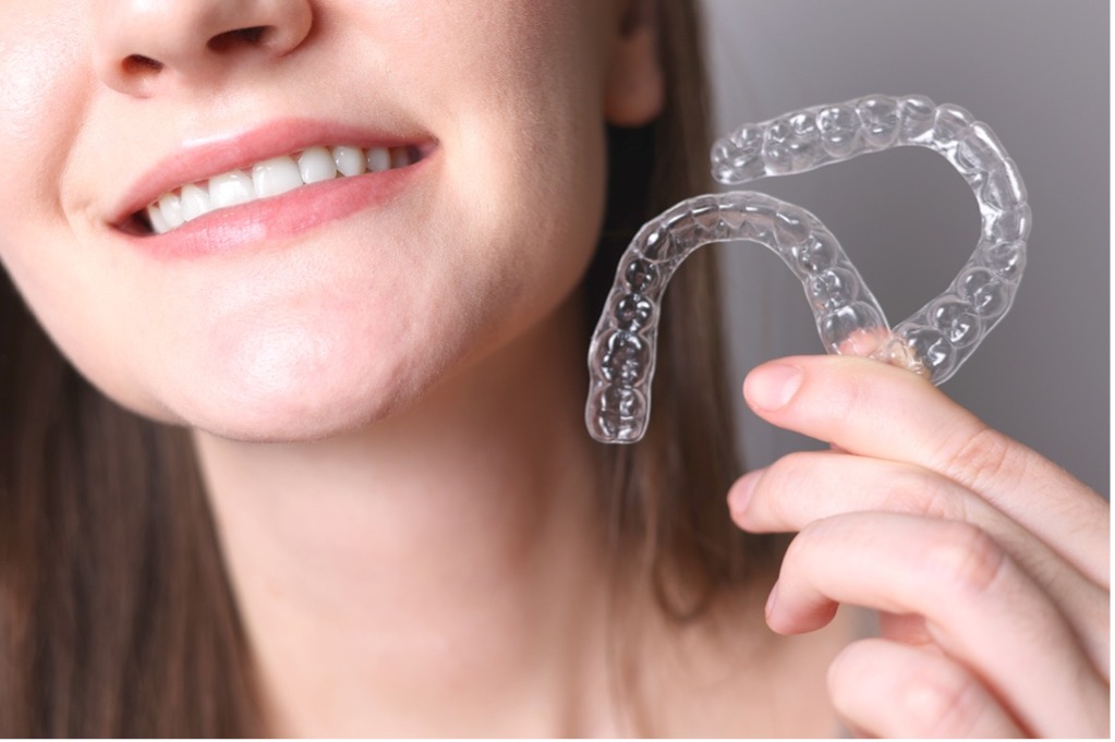 Leczenie Invisalign, czyli niewidoczna rewolucja z USA, którą pokochały gwiazdy i pacjenci Vilamed