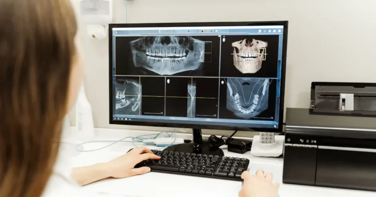 cbct